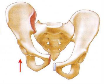 Latero-lateral Antero-posterior