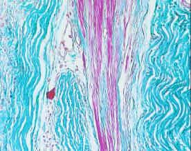 c e c m e 1 2 f c e 3 m Figura 14: fotomicrografias de áreas adjacentes às mioplastias em