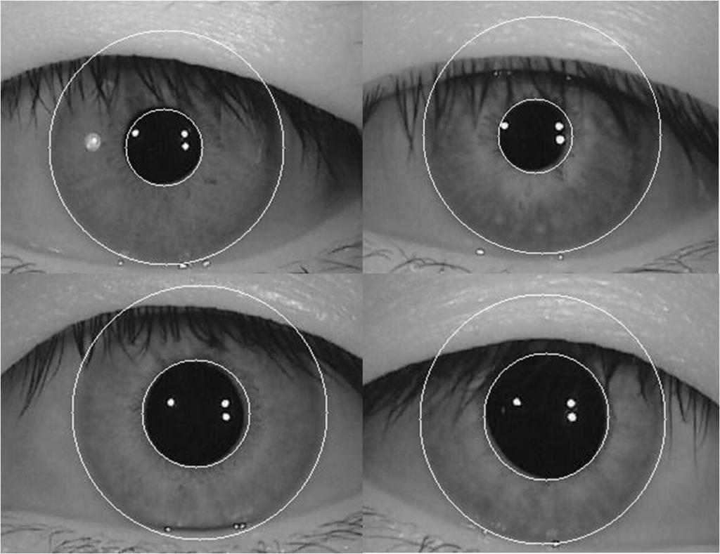 Figura 4.3: Exemplos de imagens com erros na segmentação da pupila pelo contorno. Figura 4.4: Exemplos de imagens com erros na segmentação da íris.