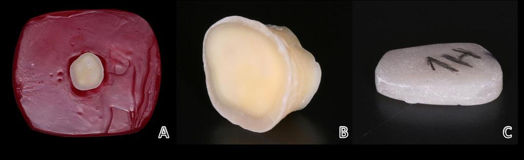 dentário (dentina e esmalte) de cada uma das amostras testes, procurando, assim, adaptação fiel da restauração temporária a cada um dos dentes. (Figura 3B e 3C).