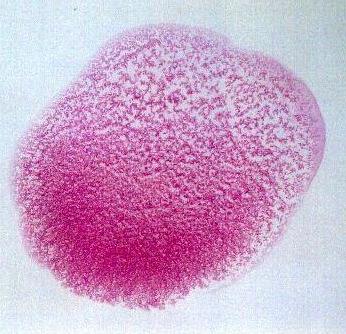 Teste do Antígeno Acidificado Tamponado - TAA Teste de Aglutinação Antígeno de B. abortus B1119-3 a 8%, corado com Rosa de Bengala, ph 3,65 tamponado Formação de grumos IgG1 Soro, plasma seminal, etc.
