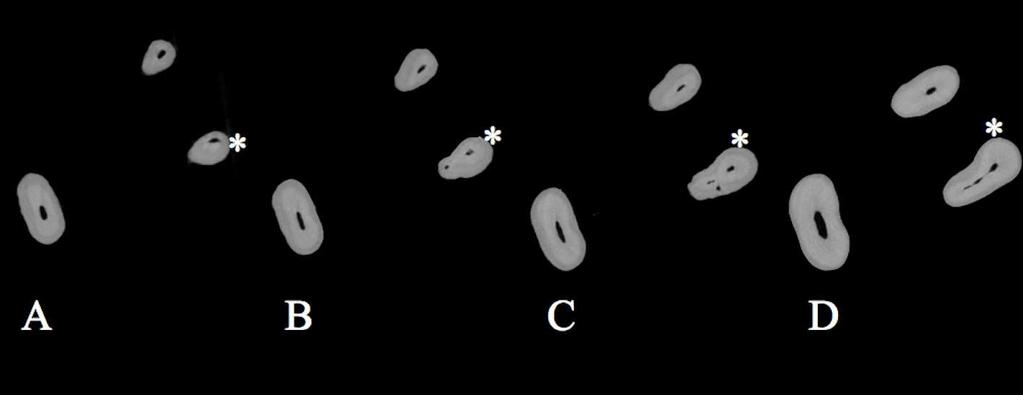 Resultados 63 Figura 13. A-Imagem bidimensional dos canais radiculares do terço apical, raiz mésio-vestibular indicada (*).