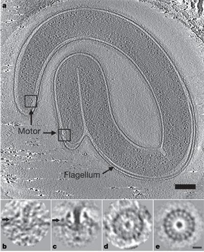 Espiroqueta: Treponema pallidum, sub espécie