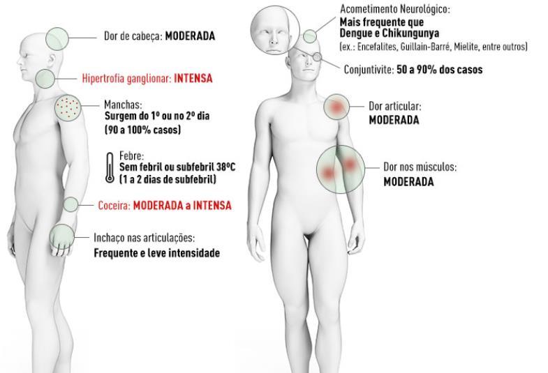 Infecção pelo vírus Zika