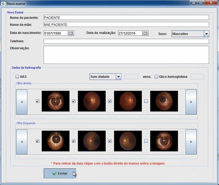 14. Atente-se para que uma das imagens da retinografia seja da região macular, ou seja, a imagem que foi capturada com o paciente olhando para frente.
