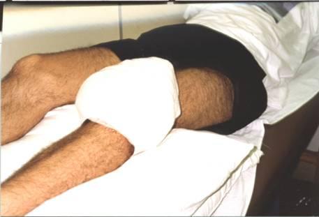 Exame funcional da lesão Exame da área ao redor da lesão Compressão: Bandagens