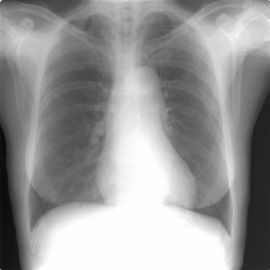 Clavículas Parênquima pulmonar Mediastino Pleura Diafragma 2.1.