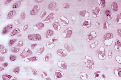 TIPOS DE CARTILAGEM: Diferenças na MEC Cartilagem Hialina: Colágeno tipo II Cartilagem Elástica: Colágeno tipo II e elastina Fibrocartilagem: Colágeno tipo I Cartilagem Hialina Colágeno