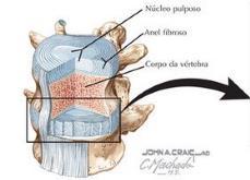 intervertebrais, discos articulares do joelho,