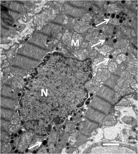 24 3.3.1 Densidade de grânulos de ANP (número total de grânulos por miócito) Nas fotomicrografias com aumento de x6000, foi obtida a densidade de grânulos de ANP (número de grânulos por miócito)