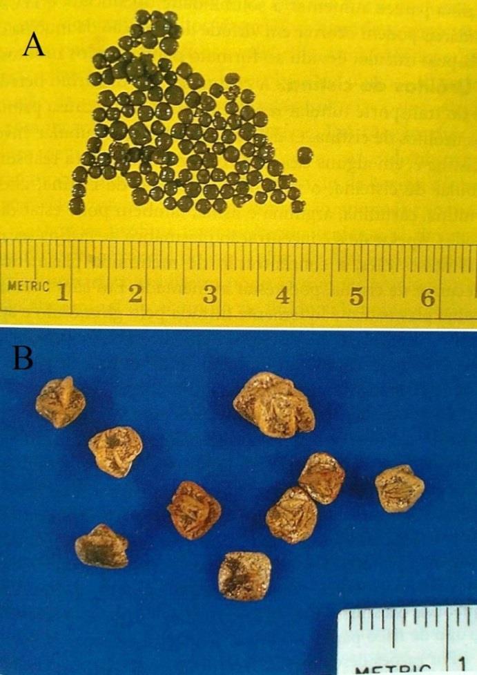 4 1.1.2. Oxalatato de cálcio Os cálculos de oxalato de cálcio (figura 2) são o tipo de urólito mais encontrado nos cães.