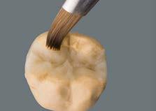 Estratificação: A construção da base do inlay é feita com uma massa VITA VM LC flow adequada à cor do dente, p.ex., CHROMA PLUS ou ENAMEL.