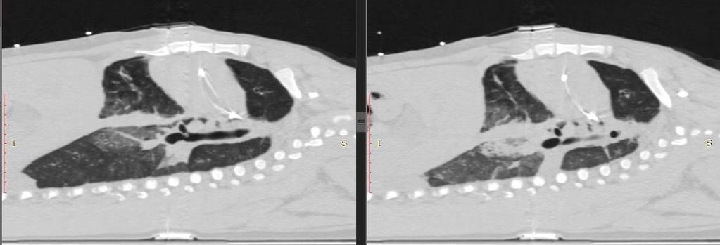 Exemplos de imagens de TC de tórax de um animal num corte coronal (parte superior) e um corte sagital (parte inferior), em ambas estratégias (TIE à esquerda e Pes à direita), mostrando que após a