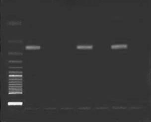 Resultados 44 Reação em Cadeia da Polimerase (PCR) Mycobacterium tuberculosis 1 2 3 4 5 6 7 8 350 pb 123 pb 50 pb FIGURA 2- Eletroforese em gel de agarose a 3%.