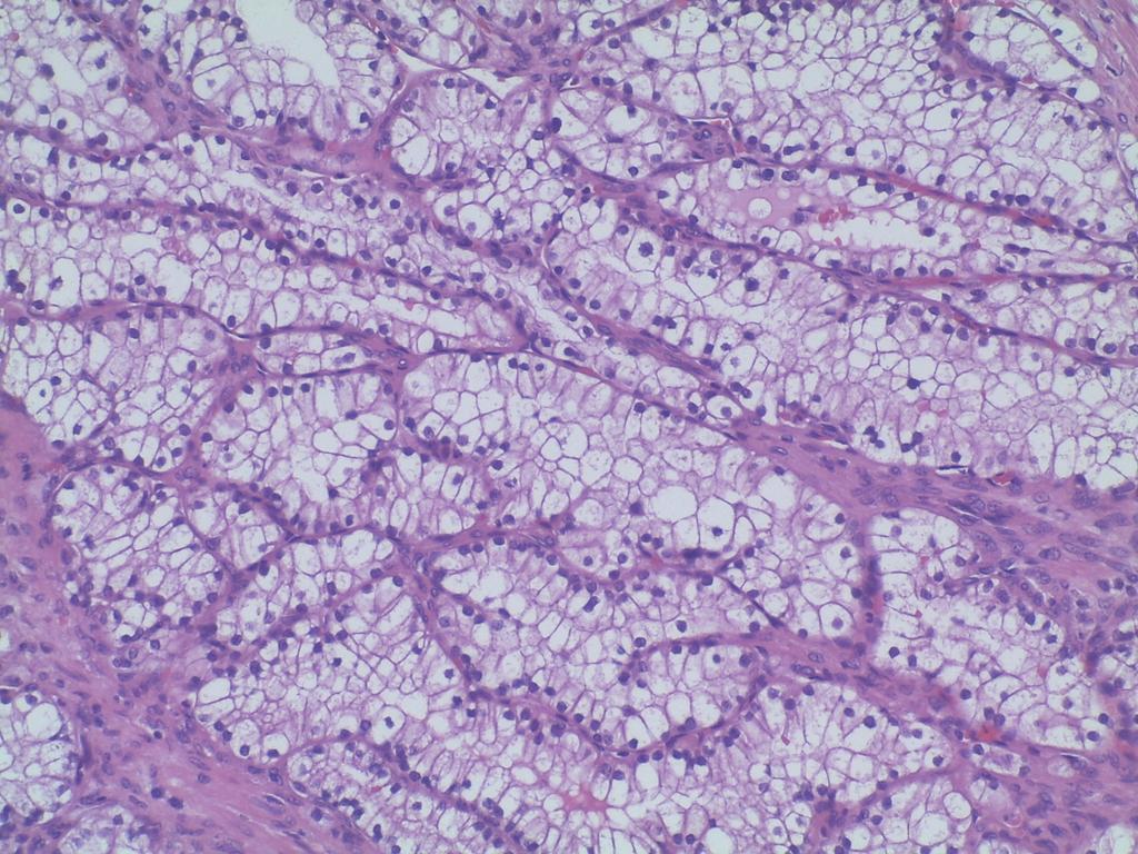 Células claras, citoplasma abundante, visível a membrana citoplasmática; núcleos