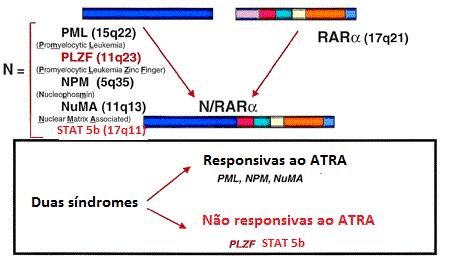 55 NPM-RARα e o RARα-NPM (REDNER, 2002). O fenótipo de LPA associado a essa translocação é morfologicamente semelhante o da LPA clássica (MELNICK; LICHT, 1999; REDNER, 2002).