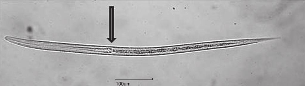 36 ALESSANDRO FRANCISCO TALAMINI DO AMARANTE Figura 26 Larva infectante de Strongyloides papillosus.