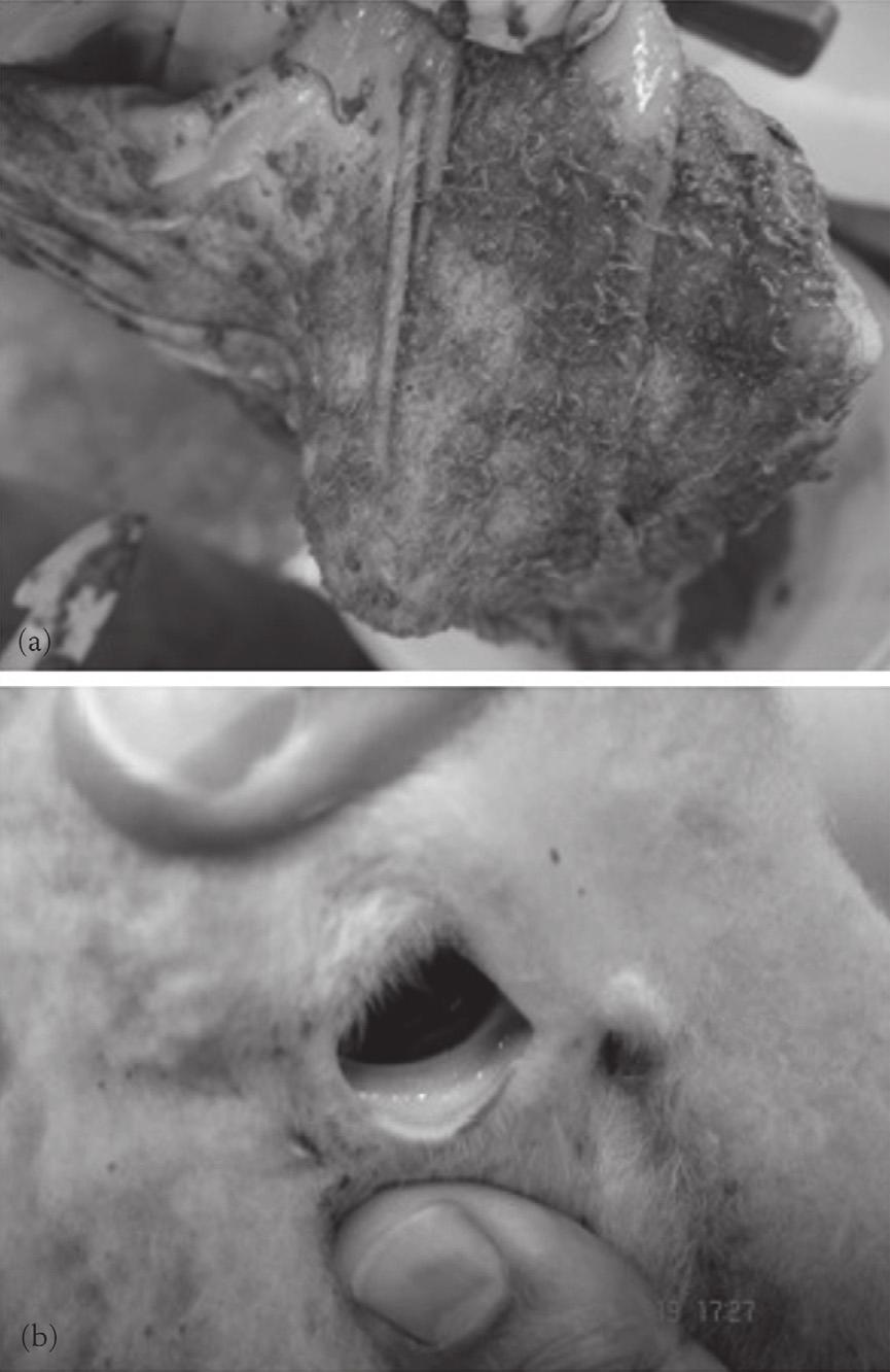 OS PARASITAS DE OVINOS 43 Figura 31 (a) Infecção maciça do abomaso por Haemonchus contortus e (b) conjuntiva ocular pálida de cordeiro com anemia severa devido a haemonchose O desenvolvimento da