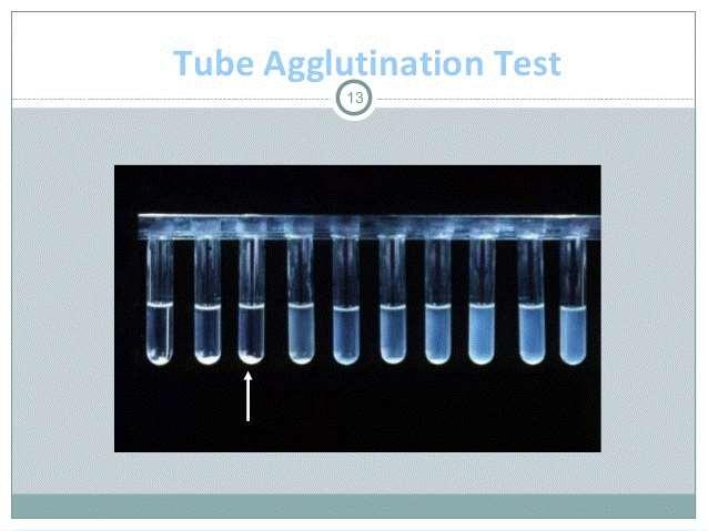 Testes Sorológicos aplicados ao