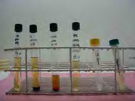Composto por soro controle positivo (frasco A), antígeno (frasco B), solução de 2-Mercaptoetanol (frasco C), pipetas e bastões para homogeneização dos