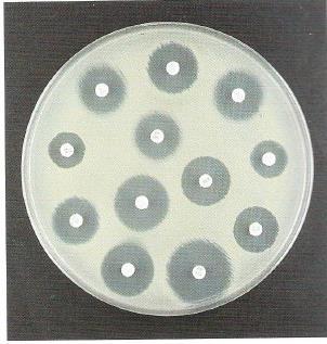 Doenças Causadas por Bactérias, Fungos e Vírus 15 Resistência a Antimicrobianos