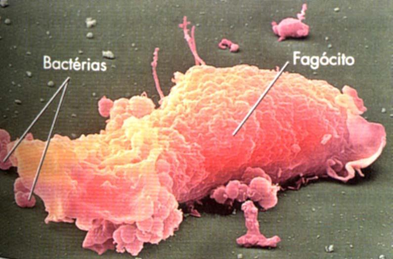 Doenças Causadas por Bactérias, Fungos e Vírus 9 Porque o S.