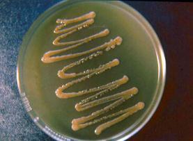 ágar Niger Ágar especial para dermatófitos (Dermatophyte Test Medium ou DTM).
