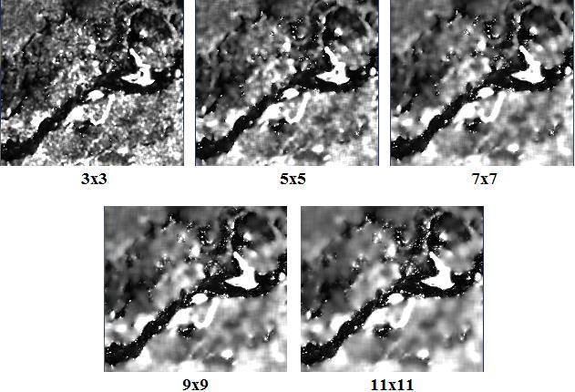 Figura 6 Efeito de diferentes tamanhos de janela utilizados na aplicação do filtro Enhanced Frost. Assim como Furtado (2014), o melhor custo-benefício foi obtido com o tamanho 5x5. 3.