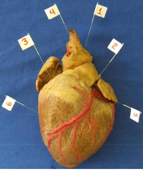 Utilização de Metodologia Ativa de Ensino nas Aulas Práticas de Anatomia Figura 2 Coração em vista esternocostal. As artérias coronárias foram injetadas com látex e depois dissecadas.