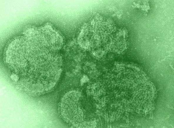 SARAMPO Vírus: Paramixovirus (RNA