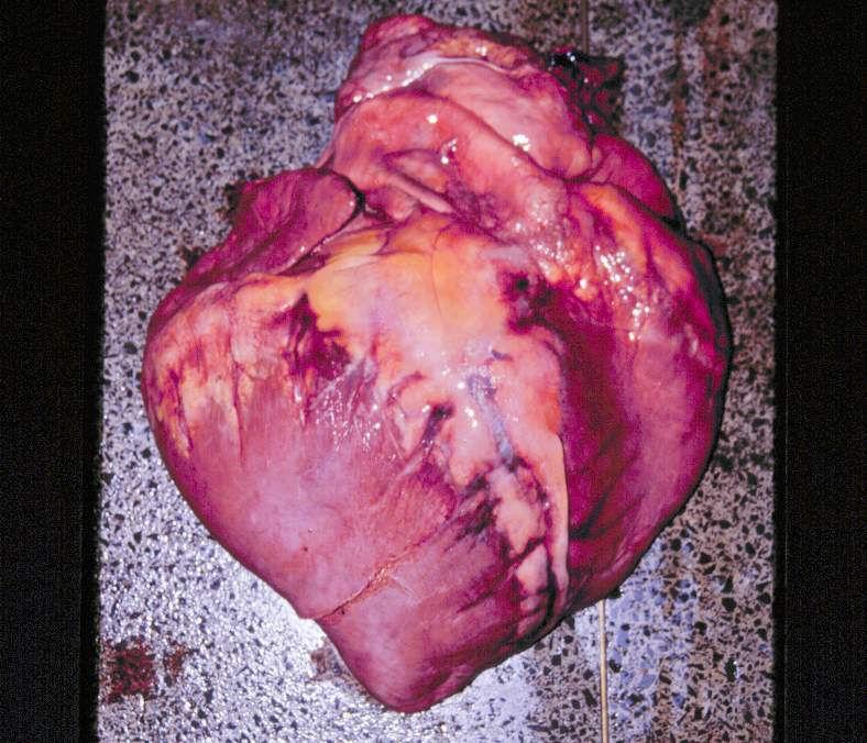 cardiomiopatias primárias (idiopáticas) ou secundárias Sem causas conhecidas