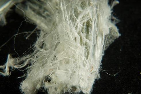 Exposição ao amianto Há dois tipos de câncer produzidos pela exposição ao asbesto:
