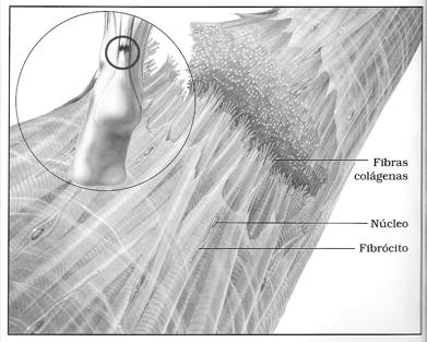 1-) Tendinite / Tenossinovite: Tratamento ortopédico: - repouso (imobilização) - anti-inflamatório e fisioterapia* 2-) Tendinose / Tendinopatia: -