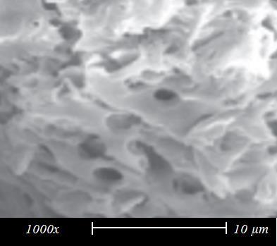 5.4.1. Microscopia Eletrônica de Varredura Uma microscopia eletrônica de varredura foi realizada para que fosse verificada a existência de microrganismos na superfície do carvão.