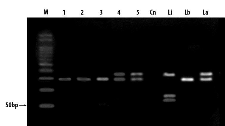 94 Figura 10 Análise por RFLP de amostras de cães positivos no ITS-1 npcr e negativos no PCR em tempo real Padrão de peso molecular (M); L. infantum (Li) (cepa MHOM/1973/BH46); L.