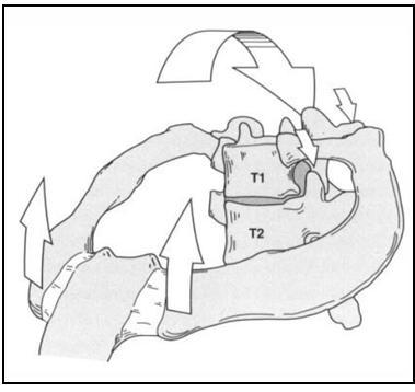 na extensão cervical, T1 leva as primeiras costelas anteriormente. Além disso, sua região posterior é deslocada caudalmente e a região anterior é deslocada cefalicamente.