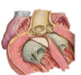 cardiopatia