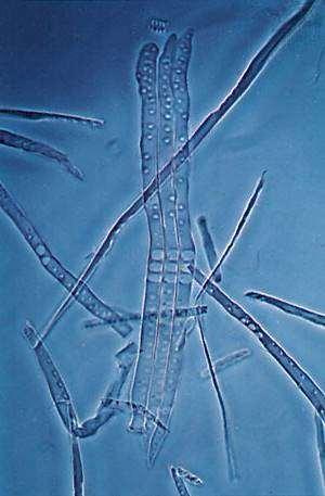 ANATOMIA DA CAULE Xilema de gimnospérmica Traqueídos de Pinus Scanning