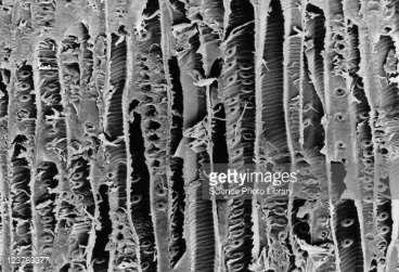 xylem) of the Scots pine, Pinus sylvestris, showing the large- celled