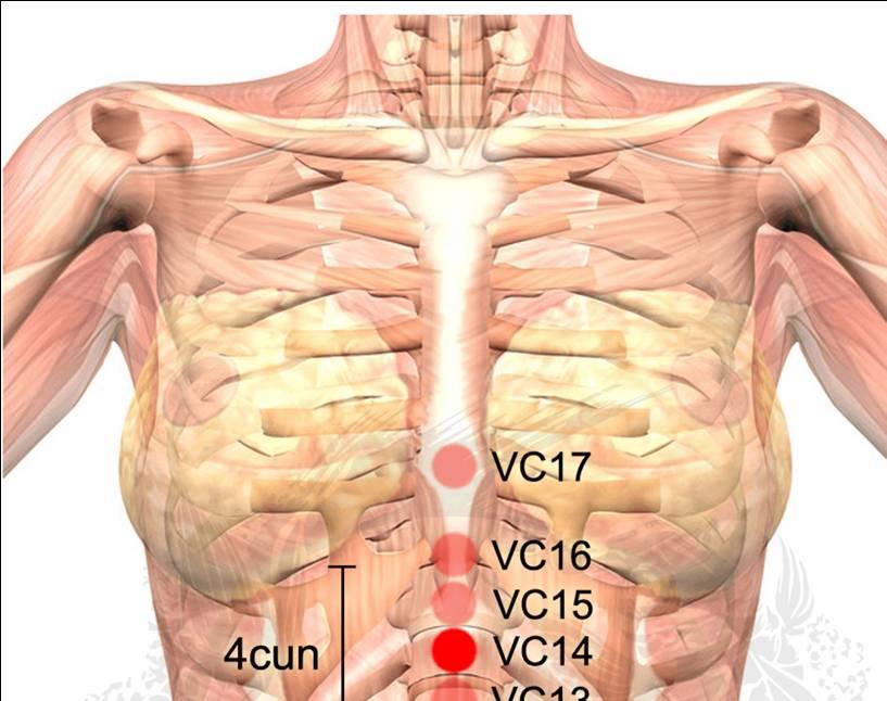 VC12