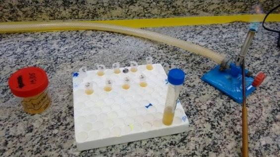 Contaminação da urina com a bactéria Staphylococcus aureus.