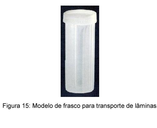 transporte