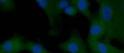 62 5.6 CÉLULAS TRONCO MARCADAS COM VYBRANT Com o intuito de demonstrar o padrão de marcação do Nanocristal fluorescente Vybrant CFDA-SE CELL nas células tronco de tecido adiposo de equinos