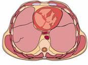 coronal) Plano