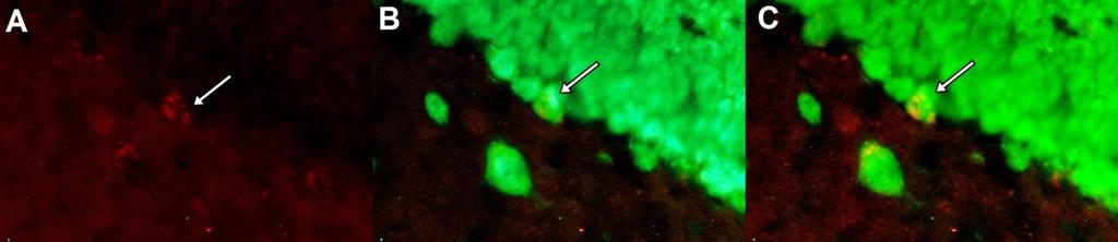 Figura 7. Fotomicrografia de secção hipocampal o Painel A mostra uma célula granular do giro denteado marcada com BrdU (Cy3).