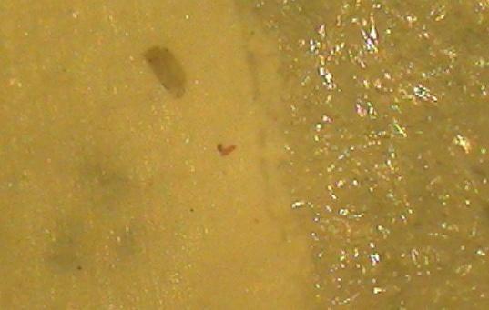 A partir dessas micrografias é constada a existência de uma camada suporte de caráter fibroso sob a camada filtrante (pele).