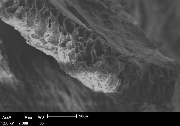 aproximadamente 8 µm de espessura e pode ser visualizada na micrografia como uma fina camada praticamente livre de poros
