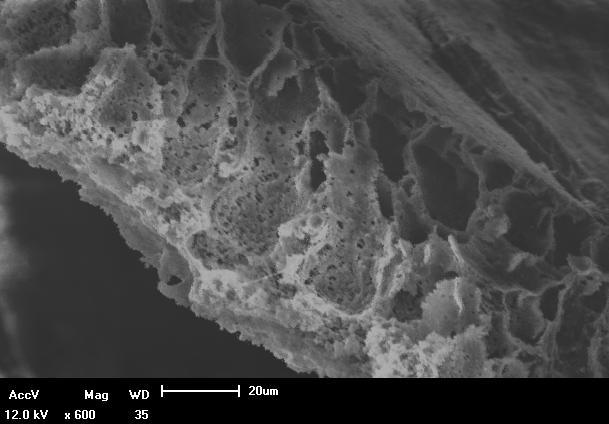 Figura 36 Micrografia da camada da pele destacada da membrana 2 com a torta aderida.