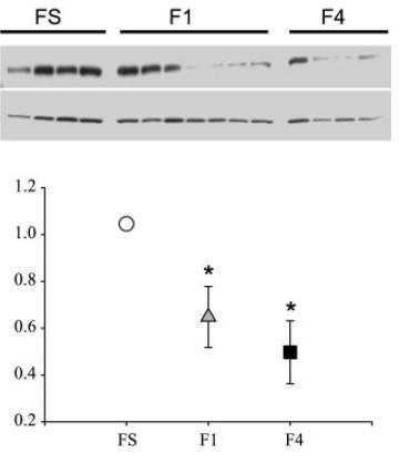 Proteína de ligação dos glicocorticóides FIGURA 4: Avaliação hepática da proteína de ligação dos glicocorticóides (CBG), proteína (57 kda) aos 3,5 ano de idade pós-natal na