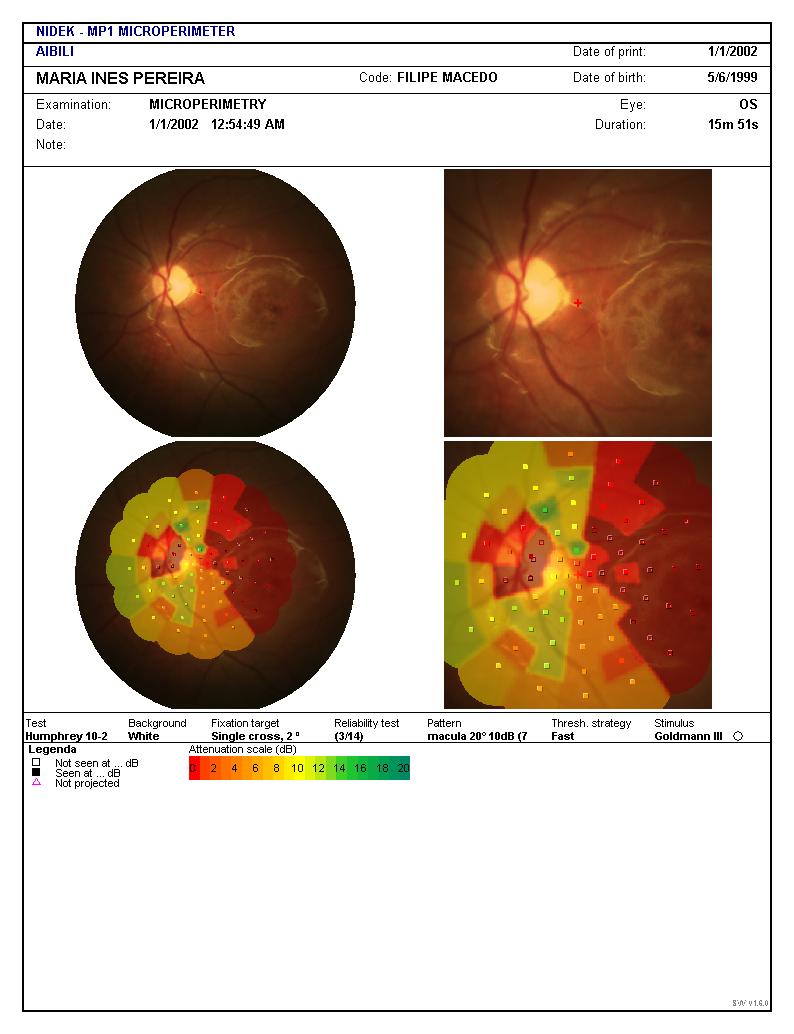 Microperimetria (cont) Imagiologia Ocular Imagens: Macedo, AF Shamir Academy, 14.